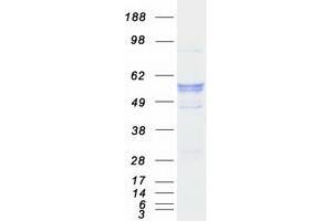 Validation with Western Blot