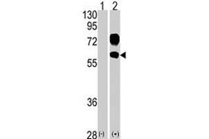 Western blot analysis of KREMEN1 (arrow) using KREMEN1 polyclonal antibody . (KREMEN1 抗体  (N-Term))