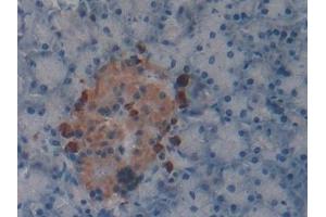 Immunohistochemistry (IHC) image for anti-Klotho beta (KLB) (AA 846-965) antibody (ABIN7436543)