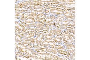 Immunohistochemistry of paraffin-embedded human liver using STING/TMEM173 Rabbit pAb (ABIN1683049, ABIN3017833, ABIN3017834 and ABIN6220283) at dilution of 1:50 (40x lens). (STING/TMEM173 抗体  (AA 170-379))