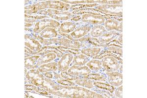 Immunohistochemistry of paraffin-embedded human liver using STING/TMEM173 Rabbit pAb (ABIN1683049, ABIN3017833, ABIN3017834 and ABIN6220283) at dilution of 1:50 (40x lens).