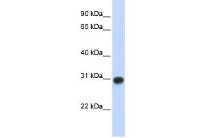 WB Suggested Anti-ZMYND19 Antibody Titration:  0. (ZMYND19 抗体  (Middle Region))