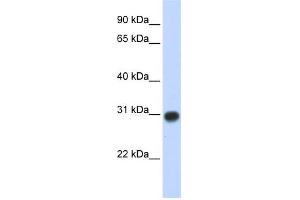 Western Blotting (WB) image for anti-Zinc Finger, MYND-Type Containing 19 (ZMYND19) (Middle Region) antibody (ABIN2784321)