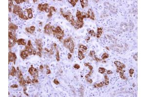 Immunohistochemistry (IHC) image for anti-Aldehyde Dehydrogenase 6 Family, Member A1 (ALDH6A1) antibody (ABIN2855626)