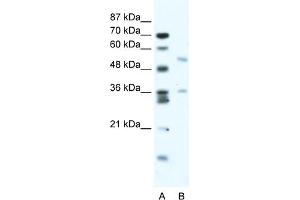 WB Suggested Anti-BTBD3 Antibody Titration:  2. (BTBD3 抗体  (Middle Region))