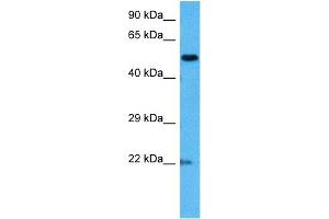 Host:  Mouse  Target Name:  MECP2  Sample Tissue:  Mouse Brain  Antibody Dilution:  1ug/ml (MECP2 抗体  (N-Term))
