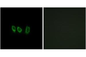 Immunofluorescence analysis of A549 cells, using CSTL1 Antibody.