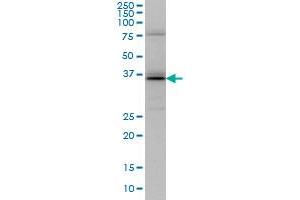 UBE2J1 monoclonal antibody (M01), clone 6A12 Western Blot analysis of UBE2J1 expression in HeLa . (UBE2J1 抗体  (AA 9-118))