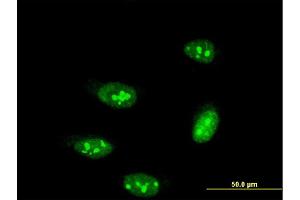Immunofluorescence of monoclonal antibody to TP53RK on HeLa cell. (TP53RK 抗体  (AA 154-253))