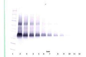 Image no. 1 for anti-Vascular Endothelial Growth Factor A (VEGFA) antibody (ABIN465335) (VEGFA 抗体)