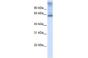 WB Suggested Anti-C3orf17 Antibody Titration:  0. (C3orf17 抗体  (Middle Region))