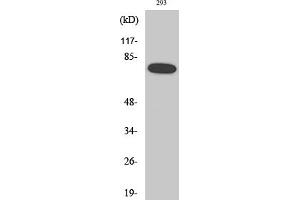 Western Blotting (WB) image for anti-Nuclear Factor-kB p65 (NFkBP65) (pSer468) antibody (ABIN5961221) (NF-kB p65 抗体  (pSer468))