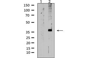 Western blot analysis of extracts from rat muscle, using AVPR2 Antibody. (AVPR2 抗体  (Internal Region))