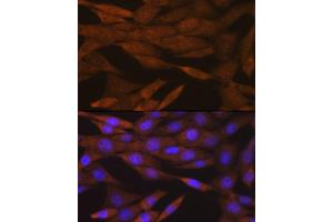 Immunofluorescence (IF) image for anti-Period Circadian Protein 2 (PER2) antibody (ABIN7269224)