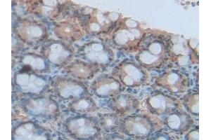 Detection of S100A6 in Rat Intestine Tissue using Polyclonal Antibody to S100 Calcium Binding Protein A6 (S100A6)