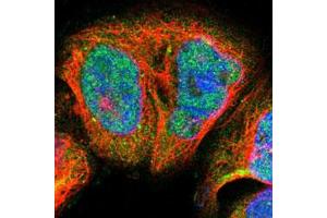 Immunofluorescent staining of A-431 cells with BLM polyclonal antibody  (Green) shows positivity in nucleus and cytoplasm. (BLM 抗体)
