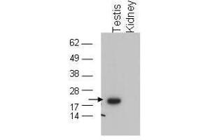 Western blot using  affinity purified anti-GPx4 to detect GPx4 in testis extract (arrow). (GPX4 抗体  (C-Term))