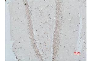 Immunohistochemical analysis of paraffin-embedded Rat Brain Tissue using NMBR Polyclonal Antibody. (NMBR 抗体)