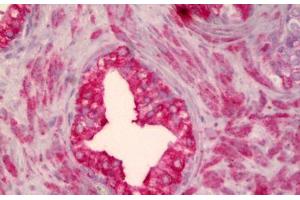 Anti-SMO antibody IHC staining of human prostate. (SMO 抗体)