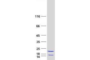 Eukaryotic Translation Initiation Factor 5A2 (EIF5A2) protein (Myc-DYKDDDDK Tag)