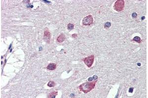Brain, cortex, Human: Formalin-Fixed, Paraffin-Embedded (FFPE) (Fatty Acid Synthase 抗体  (AA 2118-2129))