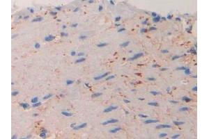 Detection of IL11Ra in Mouse Small intestine Tissue using Polyclonal Antibody to Interleukin 11 Receptor Alpha (IL11Ra)