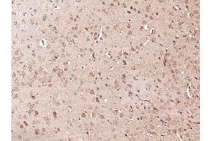 Paraformaldehyde-fixed, paraffin embedded rat brain, Antigen retrieval by boiling in sodium citrate buffer (pH6) for 15min, Block endogenous peroxidase by 3% hydrogen peroxide for 30 minutes, Blocking buffer (normal goat serum) at 37°C for 20min, Antibody incubation with RPS6KA1(Thr348) Polyclonal Antibody  at 1:400 overnight at 4°C, followed by a conjugated secondary and DAB staining. (RPS6KA1 抗体  (pThr348))