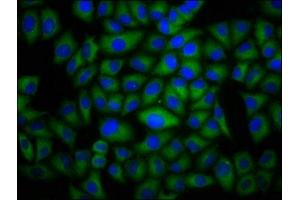 Immunofluorescence staining of Hela cells with ABIN7150914 at 1:100, counter-stained with DAPI. (Dysferlin 抗体  (AA 105-278))