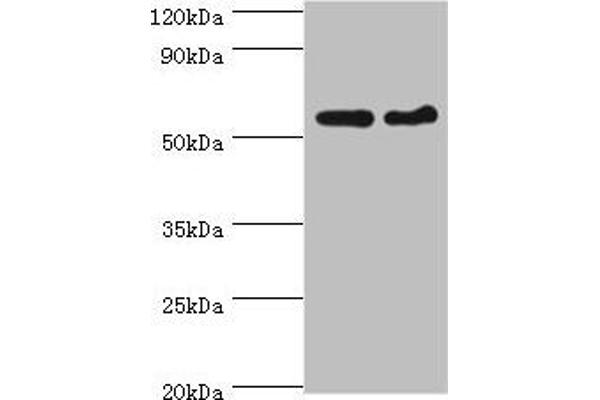 CDK16 Antikörper  (AA 277-496)