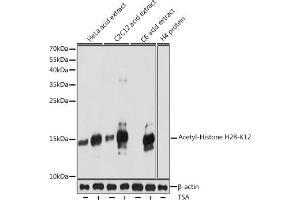 Western blot analysis of extracts of various cell lines, using Acetyl-Histone H2B-K12 antibody (ABIN7267731) at 1:1000 dilution. (Histone H2B 抗体  (acLys12))