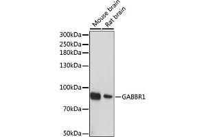Western blot analysis of extracts of various cell lines, using G antibody (ABIN6131686, ABIN6140882, ABIN6140883 and ABIN6214785) at 1:1000 dilution. (GABBR1 抗体  (AA 200-460))