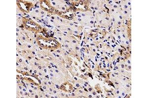 Immunohistochemistry of paraffin-embedded Rat kidney using BCHE Polyclonal Antibody at dilution of 1:100 (40x lens). (Butyrylcholinesterase 抗体)