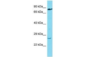Host: Rabbit Target Name: SSX2 Sample Type: Lung Tumor lysates Antibody Dilution: 1. (SSX2 抗体  (Middle Region))