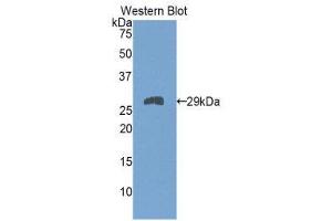 Western Blotting (WB) image for anti-Slow Skeletal Troponin T (TNNT1) (AA 1-228) antibody (ABIN1860819) (TNNT1 抗体  (AA 1-228))