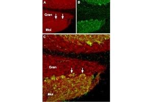 Immunohistochemistry (IHC) image for anti-Transient Receptor Potential Cation Channel, Subfamily C, Member 1 (TRPC1) (AA 557-571), (Intracellular) antibody (ABIN7043815)