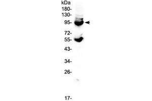 Western blot testing of mouse lung tissue lysate with CD105 antibody at 0. (Endoglin 抗体)