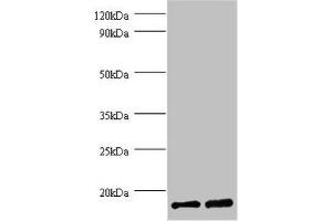 Western blot All lanes: FKBP1A antibody at 2 μg/mL Lane 1: EC109 whole cell lysate Lane 2: 293T whole cell lysate Secondary Goat polyclonal to rabbit IgG at 1/15000 dilution Predicted band size: 12 kDa Observed band size: 12 kDa (FKBP1A 抗体  (AA 2-103))