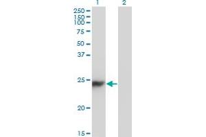Western Blotting (WB) image for anti-Chromobox Homolog 5 (CBX5) (AA 1-191) antibody (ABIN565097)