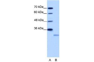 WB Suggested Anti-EIF4E2  Antibody Titration: 2. (EIF4E2 抗体  (N-Term))