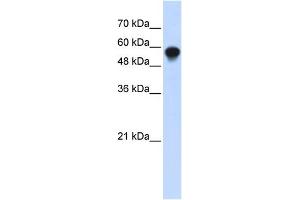 WB Suggested Anti-IRF6 Antibody Titration:  0. (IRF6 抗体  (Middle Region))