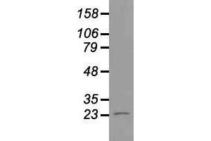 Western blot analysis of 35 µg of cell extracts from human Liver carcinoma (HepG2) cells using anti-NEUROG1 antibody. (Neurogenin 1 抗体)