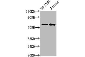 Western Blot Positive WB detected in: SH-SY5Y whole cell lysate, Jurkat whole cell lysate All lanes: MGAT4B antibody at 3 μg/mL Secondary Goat polyclonal to rabbit IgG at 1/50000 dilution Predicted band size: 64, 65 kDa Observed band size: 64 kDa (MGAT4B 抗体  (AA 380-522))