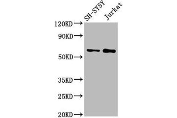 MGAT4B 抗体  (AA 380-522)