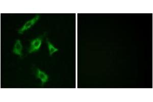 Immunofluorescence analysis of COS7 cells, using Stathmin 1 (Ab-15) Antibody. (Stathmin 1 抗体  (AA 5-54))