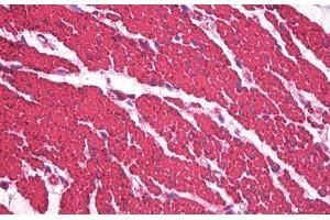 Image no. 5 for anti-Actin, alpha 1, Skeletal Muscle (ACTA1) antibody (ABIN1502284)