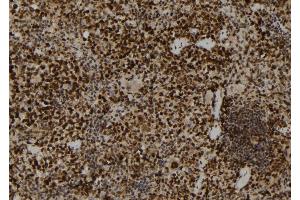 ABIN6272859 at 1/100 staining Mouse spleen tissue by IHC-P. (PADI2 抗体  (Internal Region))