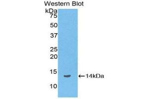 Western Blotting (WB) image for anti-Lipotropin, beta - (AA 179-267) antibody (ABIN1858144) (Lipotropin, beta - (AA 179-267) 抗体)