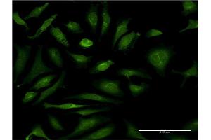 Immunofluorescence (IF) image for anti-Cysteine Sulfinic Acid Decarboxylase (CSAD) (AA 1-98) antibody (ABIN526690)