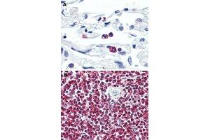 Immunohistochemical (Formalin/PFA-fixed paraffin-embedded sections) staining in human neutrophils (A) and human spleen (B) with LGR6 polyclonal antibody . (LGR6 抗体  (Internal Region))