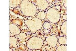 Immunohistochemistry of paraffin-embedded human thyroid tissue using ABIN7158468 at dilution of 1:100 (ICE1 (AA 1213-1505) 抗体)